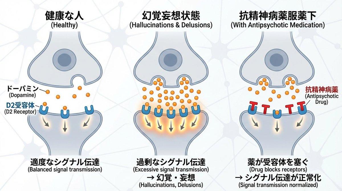 AI generated image for Dopamine, D2 Receptors, and Schizophrenia Diagram
